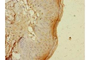 Immunohistochemistry of paraffin-embedded human skin tissue using ABIN7172192 at dilution of 1:100 (TIGD4 Antikörper  (AA 301-512))