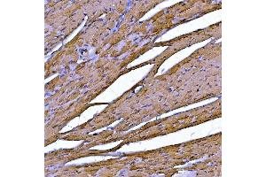 IHC analysis of Sarcalumenin/Srl using anti-Sarcalumenin/Srl antibody (ABIN7599804). (Sarcalumenin Antikörper  (AA 119-422))
