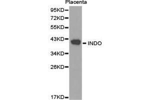 Western Blotting (WB) image for anti-Indoleamine 2,3-Dioxygenase 1 (IDO1) antibody (ABIN1873231) (IDO1 Antikörper)