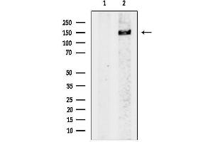 Western blot analysis of lysates from Mouse brain, using Neurofilament heavy polypeptide.