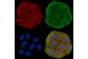 ABIN7095684 and ABIN7099746 staining Hela cells(30 min of UV treatment) by IF/ICC. (KLHL26 Antikörper)