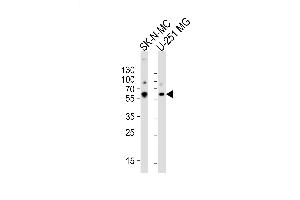 Western blot analysis of lysates from SK-N-MC, U-251 MG cell line (from left to right), using PNUTL2 Antibody (N-term) (ABIN1944842 and ABIN2841726).
