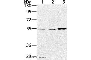 Western blot analysis of Lovo, hela and SKOV3 cell, using SESN2 Polyclonal Antibody at dilution of 1:300 (Sestrin 2 Antikörper)