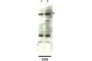 Image no. 1 for anti-SMAD Family Member 4 (SMAD4) (C-Term) antibody (ABIN401410) (SMAD4 Antikörper  (C-Term))