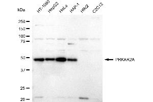 Western blotting analysis using PRKAR2A antibody (ABIN7800012).