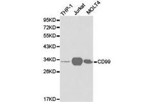 Western Blotting (WB) image for anti-CD99 (CD99) antibody (ABIN1871666) (CD99 Antikörper)