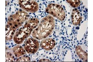 Image no. 2 for anti-Aminoacylase 3 (ACY3) antibody (ABIN1496465) (Aminoacylase 3 Antikörper)
