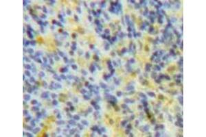 Used in DAB staining on fromalin fixed paraffin-embedded Spleen tissue (SOCS3 Antikörper  (AA 1-225))