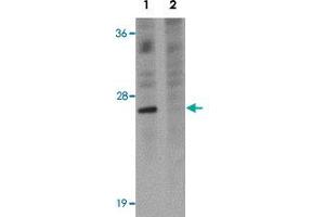 Western blot analysis of EL4 cells with TSPAN9 polyclonal antibody  at 1 ug/mL in (Lane 1) the absence and (Lane 2) the presence of blocking peptide.