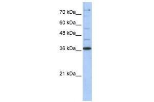 GAPDH antibody used at 1 ug/ml to detect target protein. (GAPDH Antikörper  (Middle Region))