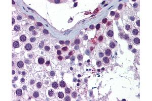 Anti-ING4 antibody IHC of human testis. (ING4 Antikörper  (AA 110-159))