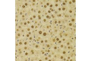 Immunohistochemistry (Paraffin-embedded Sections) (IHC (p)) image for anti-Hepatoma-Derived Growth Factor (HDGF) (AA 1-240) antibody (ABIN6141694)
