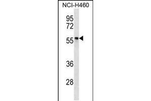 Western blot analysis in NCI-H460 cell line lysates (35ug/lane). (PHAX Antikörper  (C-Term))
