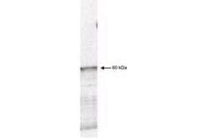 Image no. 1 for anti-3-phosphoinositide Dependent Protein Kinase-1 (PDPK1) (AA 301-312) antibody (ABIN199938) (PDPK1 Antikörper  (AA 301-312))