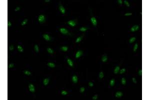 Immunofluorescence staining of Hela Cells with ABIN7127571 at 1:50, counter-stained with DAPI. (Rekombinanter Interleukin enhancer-binding factor 3 (ILF3) Antikörper)