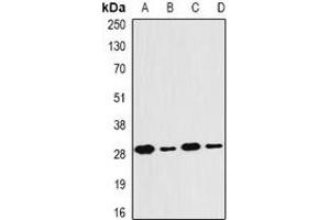 Western Blotting (WB) image for anti-Proteasome (Prosome, Macropain) Subunit, beta Type, 4 (PSMB4) antibody (ABIN7306370)