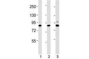 Western blot testing of Suz12 antibody at 1:2000 dilution. (SUZ12 Antikörper  (AA 381-395))