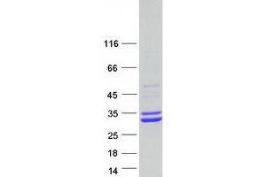 Western Blotting (WB) image for Enoyl CoA Hydratase, Short Chain, 1, Mitochondrial (ECHS1) protein (Myc-DYKDDDDK Tag) (ABIN2719921)