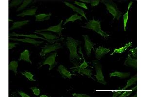 Immunofluorescence of monoclonal antibody to HTT on HeLa cell. (Huntingtin Antikörper  (AA 1524-1627))