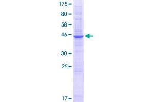 Image no. 1 for PQ Loop Repeat Containing 2 (PQLC2) (AA 1-226) protein (GST tag) (ABIN1316112) (PQLC2 Protein (AA 1-226) (GST tag))