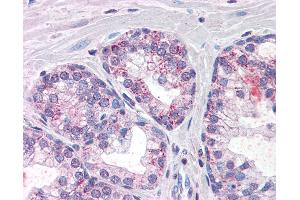 Anti-PDE11A antibody IHC of human prostate. (PDE11A Antikörper  (AA 455-468))