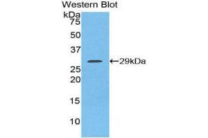 Western Blotting (WB) image for anti-Fibroblast Growth Factor Receptor 2 (FGFR2) (AA 157-377) antibody (ABIN3206051) (FGFR2 Antikörper  (AA 157-377))