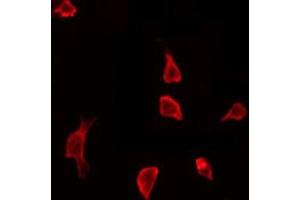 ABIN6267646 staining HeLa by IF/ICC. (Cortactin Antikörper  (pTyr466))