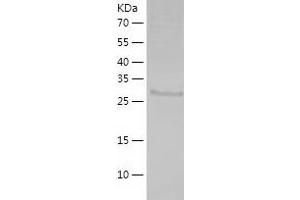 Western Blotting (WB) image for Inositol(myo)-1(or 4)-Monophosphatase 2 (IMPA2) (AA 1-288) protein (His tag) (ABIN7284295) (IMPA2 Protein (AA 1-288) (His tag))