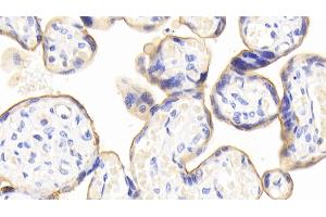 Detection of CD73 in Human Placenta Tissue using Polyclonal Antibody to Cluster Of Differentiation 73 (CD73) (CD73 Antikörper  (AA 29-500))