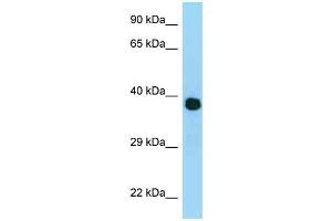 WB Suggested Anti-MRPL3 Antibody Titration: 1.