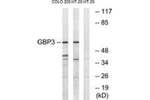 Western blot analysis of extracts from HT-29/COLO cells, using GBP3 Antibody. (GBP3 Antikörper  (AA 481-530))