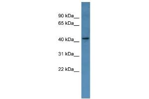 WB Suggested Anti-MAGEA11 Antibody Titration: 0. (MAGEA11 Antikörper  (Middle Region))