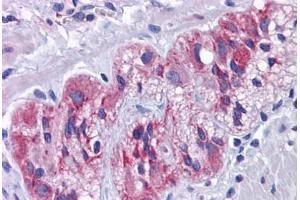 Human Colon, Myenteric Plexus: Formalin-Fixed, Paraffin-Embedded (FFPE) (SLC39A7 Antikörper  (N-Term))