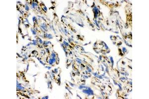 IHC analysis of ACE using anti-ACE antibody (ABIN3043777).