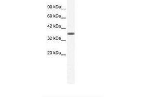 Image no. 1 for anti-Annexin A3 (ANXA3) (C-Term) antibody (ABIN202242) (Annexin A3 Antikörper  (C-Term))