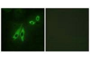 Immunofluorescence analysis of NIH/3T3 cells, using AKAP3 antibody. (AKAP3 Antikörper)