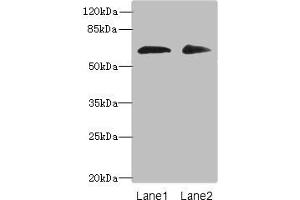Western blot All lanes: ZNF529 antibody at 6 μg/mL Lane 1: Hela whole cell lysate Lane 2: MCF-7 whole cell lysate Secondary Goat polyclonal to rabbit IgG at 1/10000 dilution Predicted band size: 66 kDa Observed band size: 66 kDa (ZNF529 Antikörper  (AA 393-563))