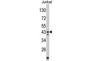 Western blot analysis of CECR5 Antibody (Center) in Jurkat cell line lysates (35ug/lane). (CECR5 Antikörper  (Middle Region))