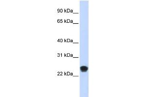 WB Suggested Anti-FKBAntibody Titration:  0.