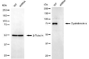 Western blotting analysis using dystrobrevin alpha antibody (ABIN7798410). (DTNA Antikörper)