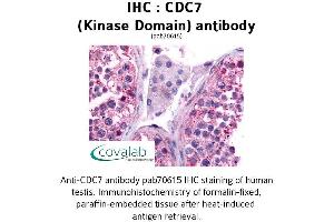 Image no. 1 for anti-Cell Division Cycle 7 (CDC7) antibody (ABIN1732913) (CDC7 Antikörper)