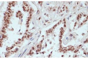 Immunohistochemistry (Paraffin-embedded Sections) (IHC (p)) image for anti-Catenin, beta (CATNB) (pSer33), (pSer37), (pThr41) antibody (ABIN7265240)
