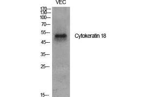 Western Blot (WB) analysis of specific cells using Cytokeratin 18 Polyclonal Antibody. (Cytokeratin 18 Antikörper  (Ser726, Ser731))