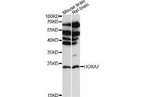 Western blot analysis of extracts of various cell lines, using HOX antibody (ABIN6128063, ABIN6141940, ABIN6141941 and ABIN6216689) at 1:3000 dilution. (HOXA7 Antikörper  (AA 1-120))