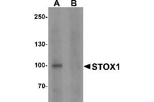 Western blot analysis of STOX1 in human liver tissue lysate with STOX1 antibody at 1 µg/mL in (A) the absence and (B) the presence of blocking peptide. (STOX1 Antikörper  (C-Term))