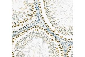 Immunohistochemistry of paraffin embedded rat testis using SLBP (ABIN7075733) at dilution of 1: 700 (300x lens)