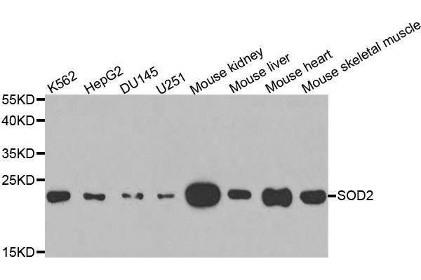 SOD2 Antikörper  (AA 25-222)