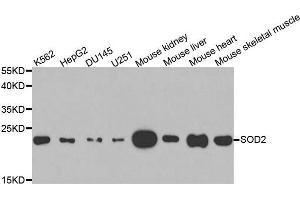 Western blot analysis of extracts of various cell lines, using SOD2 antibody. (SOD2 Antikörper  (AA 25-222))