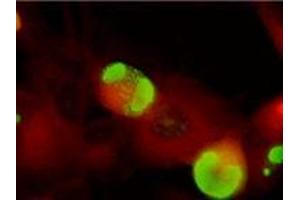 Immunofluorescence (IF) image for anti-ICP36 DNA Binding Protein (CMV ICP36) antibody (ABIN265542) (ICP36 DNA Binding Protein (CMV ICP36) Antikörper)