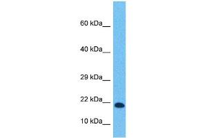 Western Blotting (WB) image for anti-Transcription Factor 21 (TCF21) (N-Term) antibody (ABIN2777930)